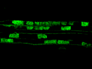 Mycorrhize à arbuscules