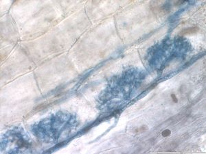 Mycorrhize à arbuscules