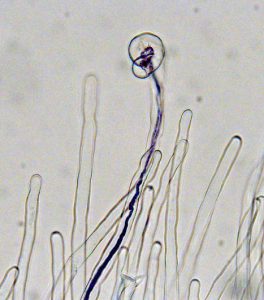 Micrograph of an infection thread