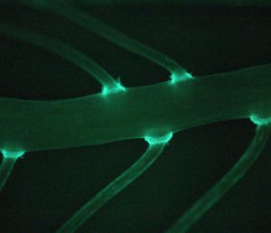 Fluorescent micrograph of a root hair