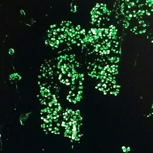 Micrograph of arbuscular mycorrhyzae inside a root