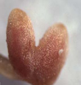 Root nodule