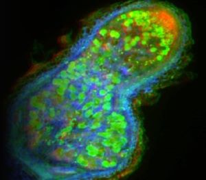 Fluorescence microscopy of a root nodule